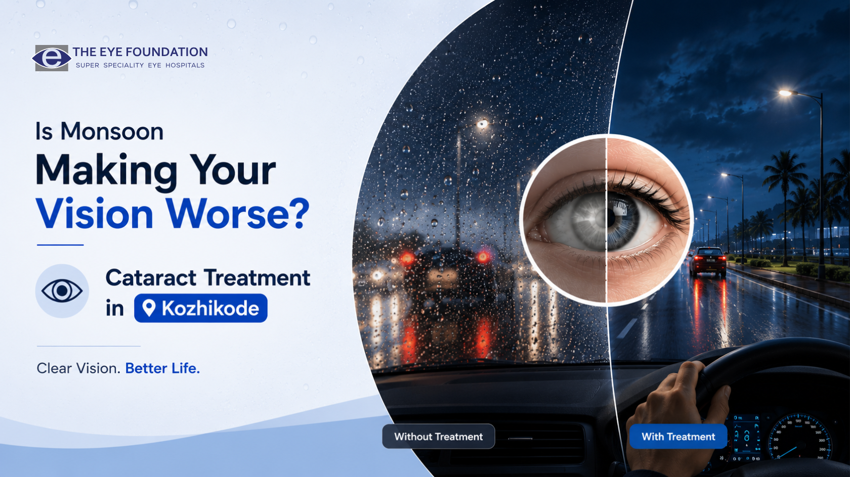 Is Monsoon Making Your Vision Worse? Cataract Treatment in Kozhikode Explained