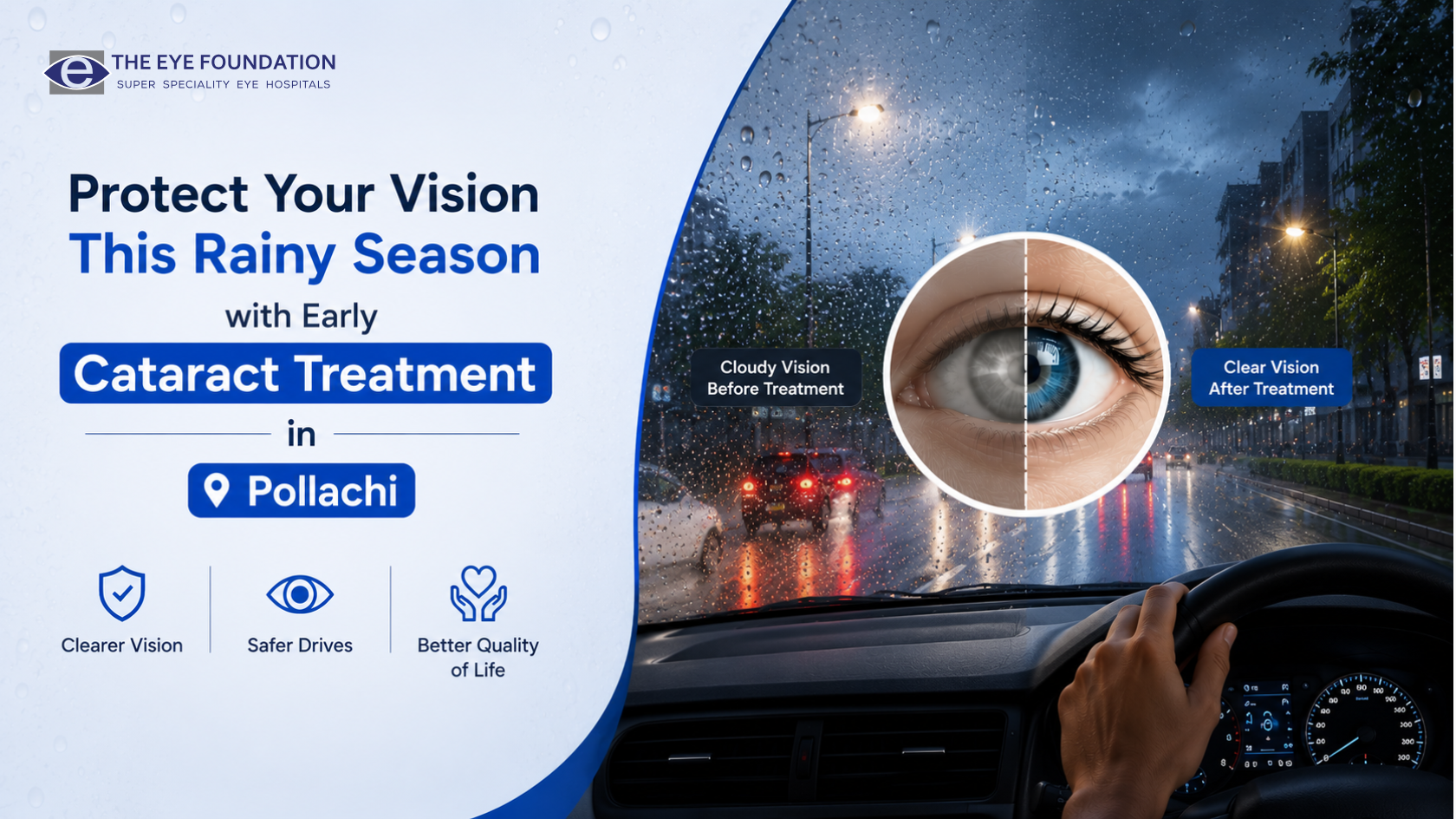 Protect Your Vision This Rainy Season with Early Cataract Treatment in Pollachi