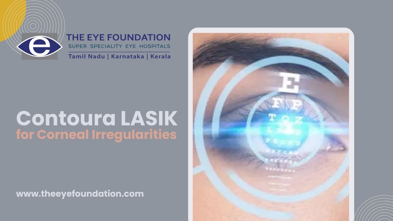 contoura-lasik-for-corneal-irregularities