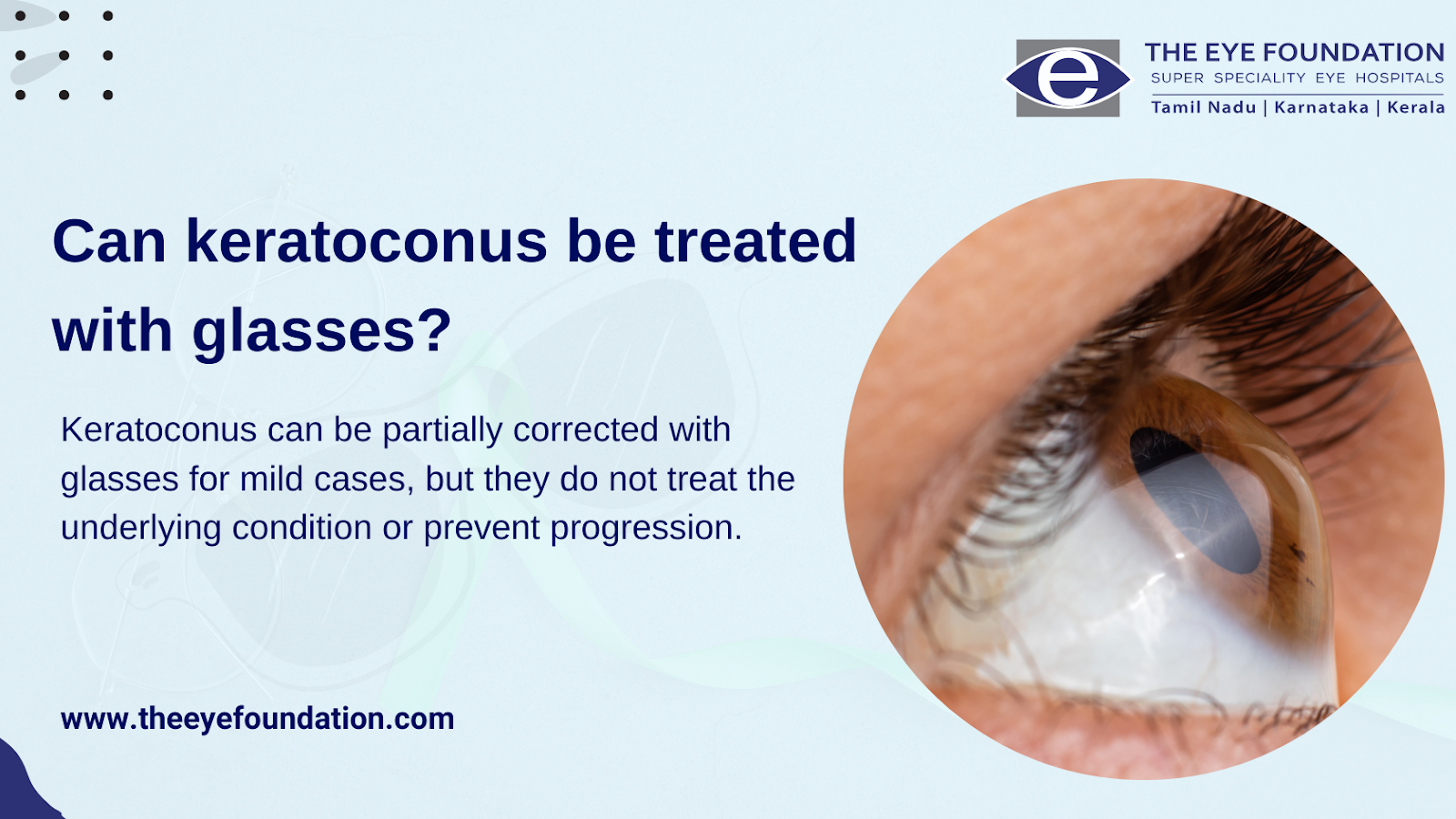 can-keratoconus-be-treated-with-glasses