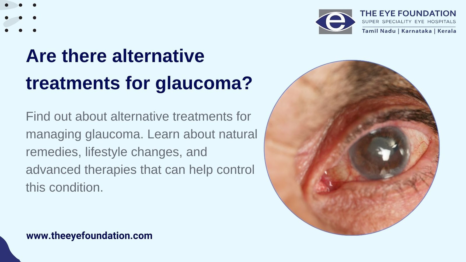 alternative-treatments-for-glaucoma