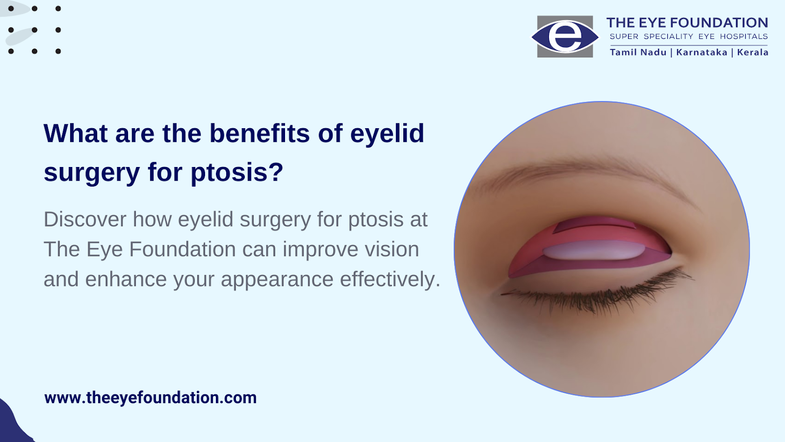 benefits-eyelid-surgery-ptosis