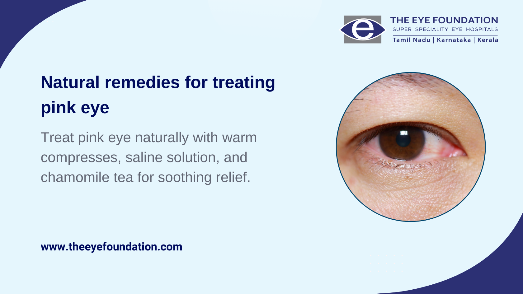 natural-remedies-treating-pink-eye
