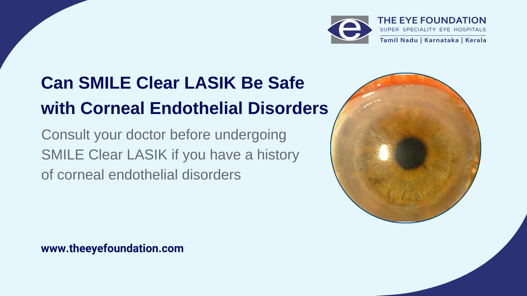 smile-clear-lasik-impact-corneal-hysteresis