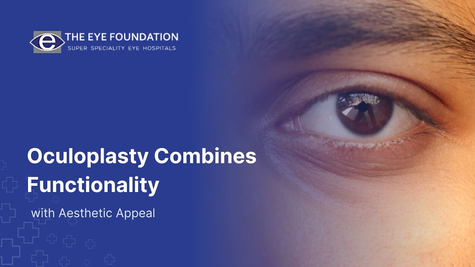 oculoplasty-functionality-aesthetic-appeal