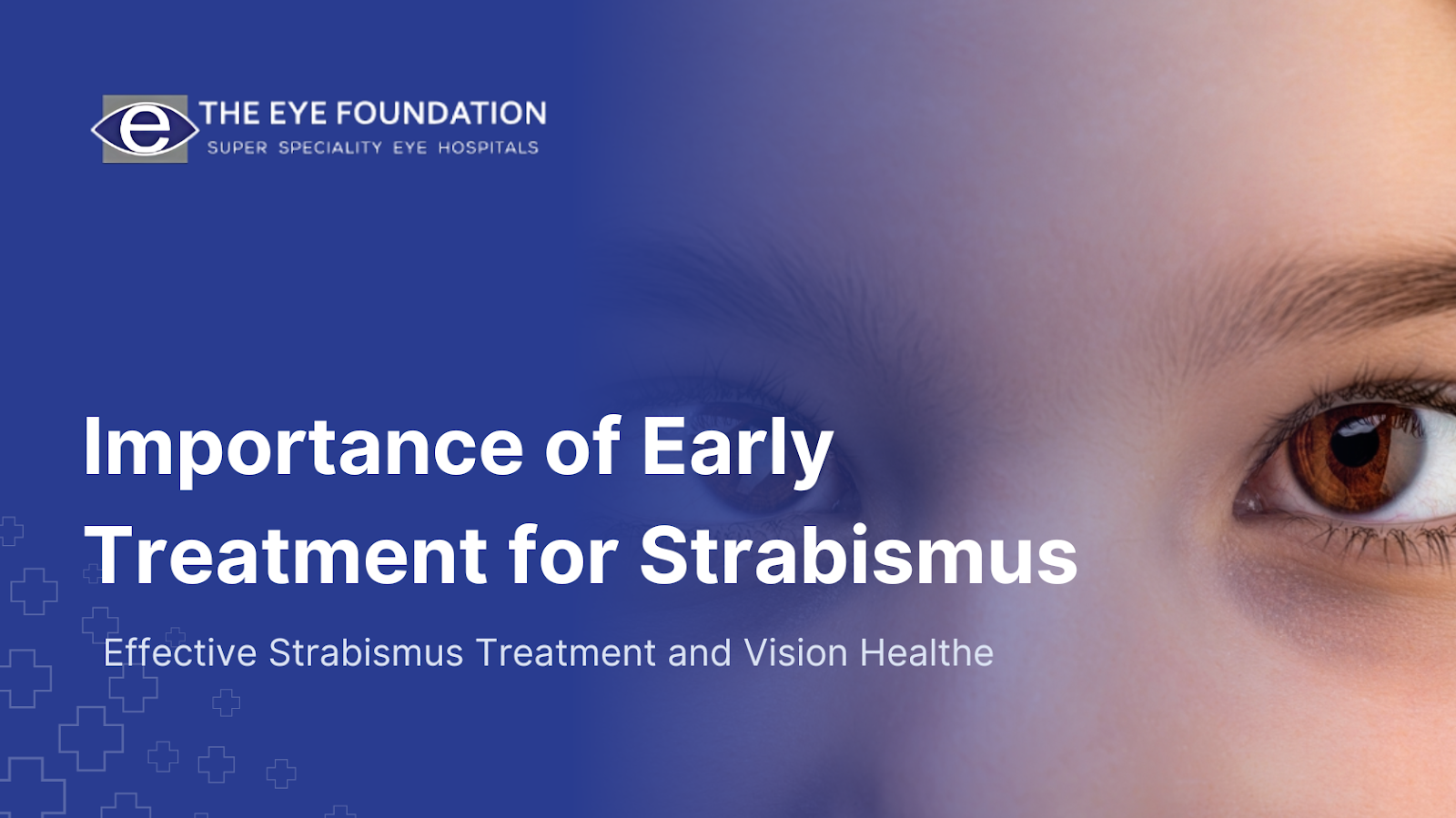 early-treatment-for-strabismus-importance
