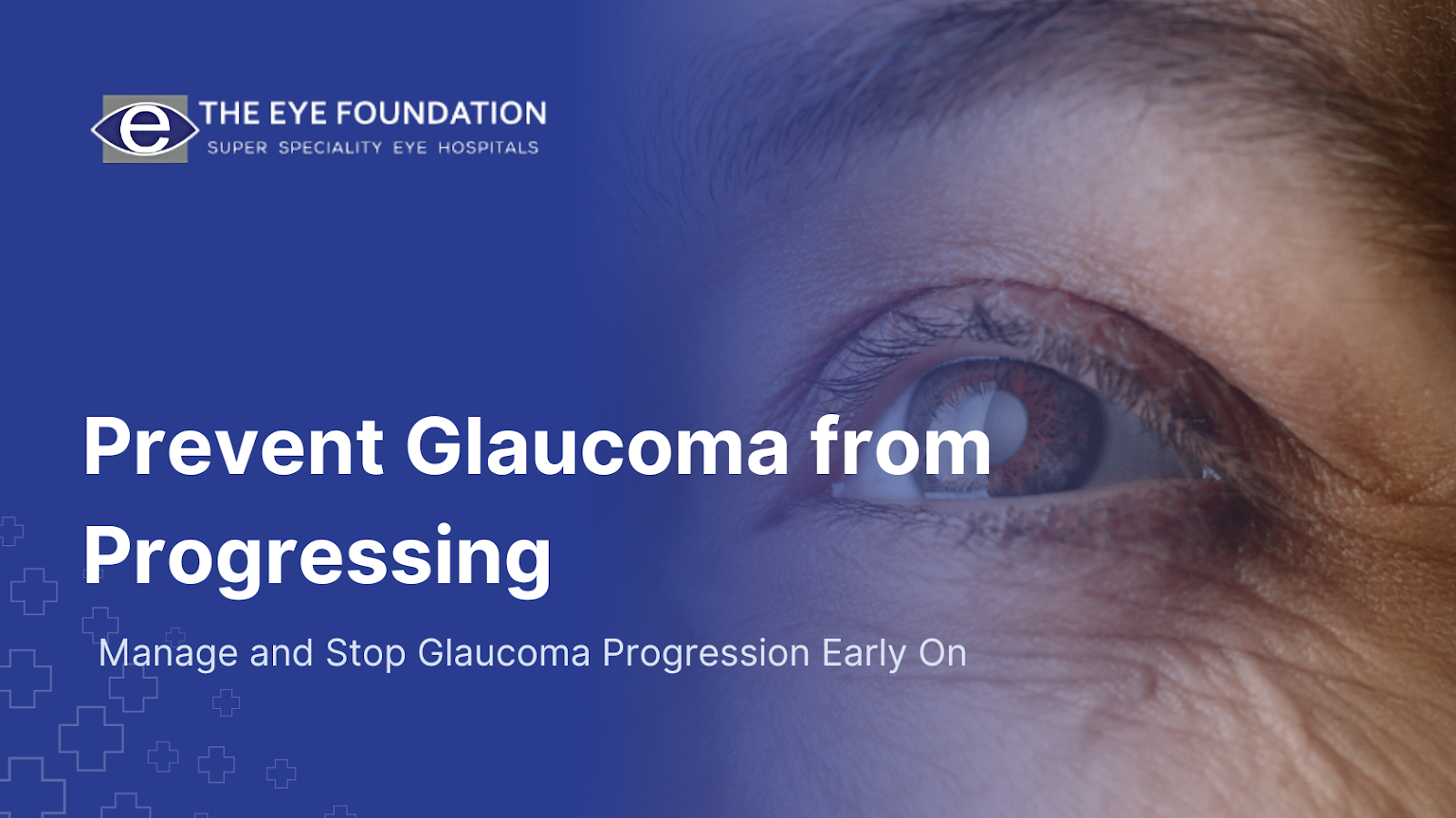 prevent-glaucoma-progression-tips