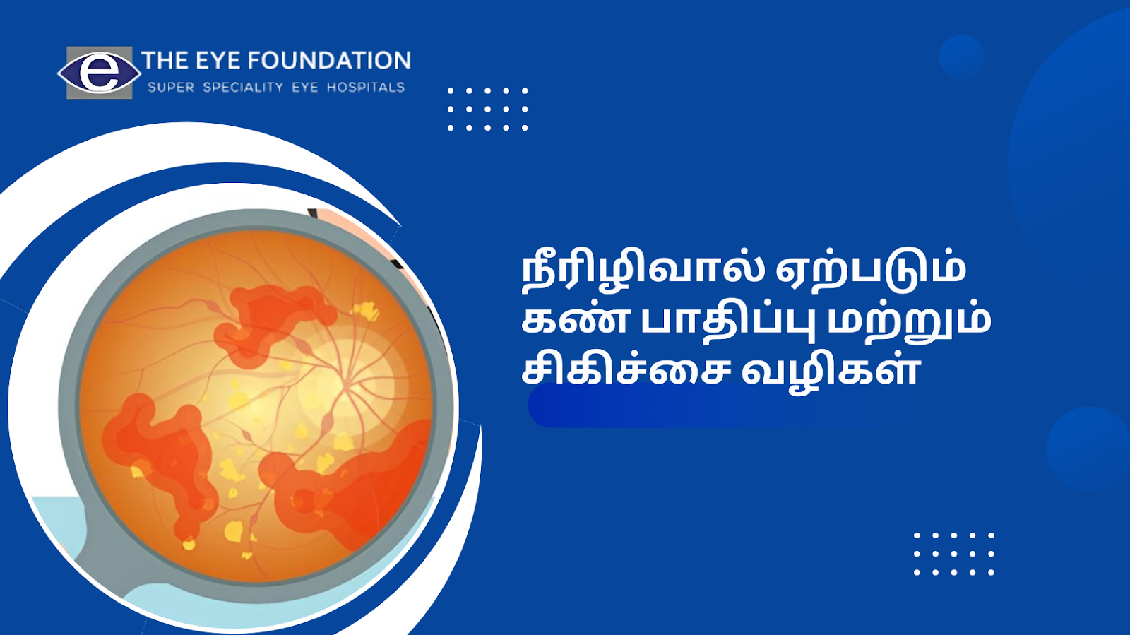 diabetic-retinopathy-macular-edema-treatment