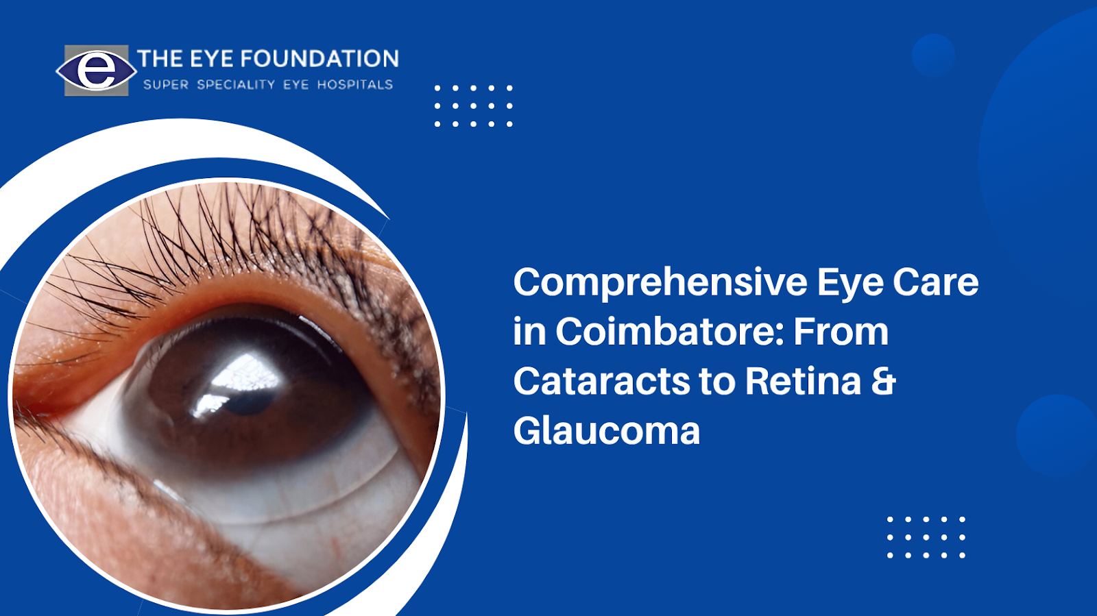 comprehensive-eye-care-coimbatore