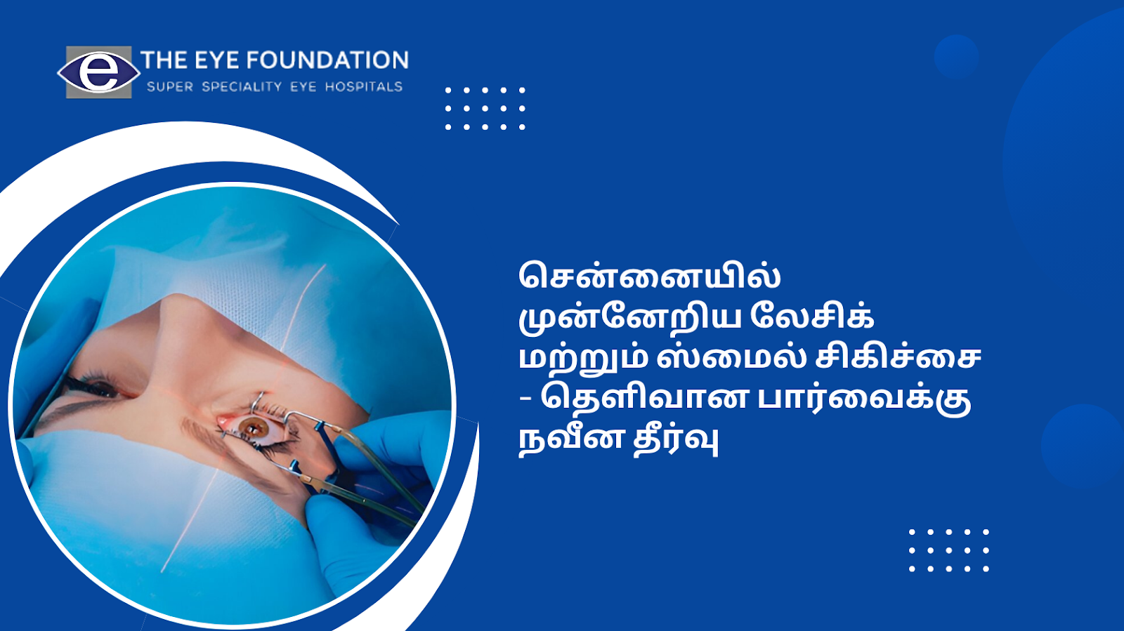 advanced-lasik-smile-treatment-chennai