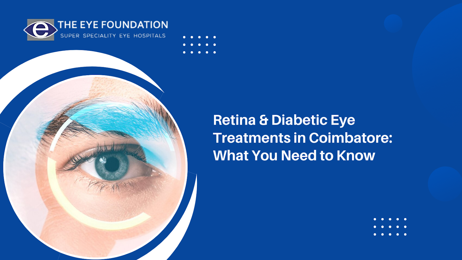 Advanced Retina and Diabetic Eye Care Treatment in Coimbatore