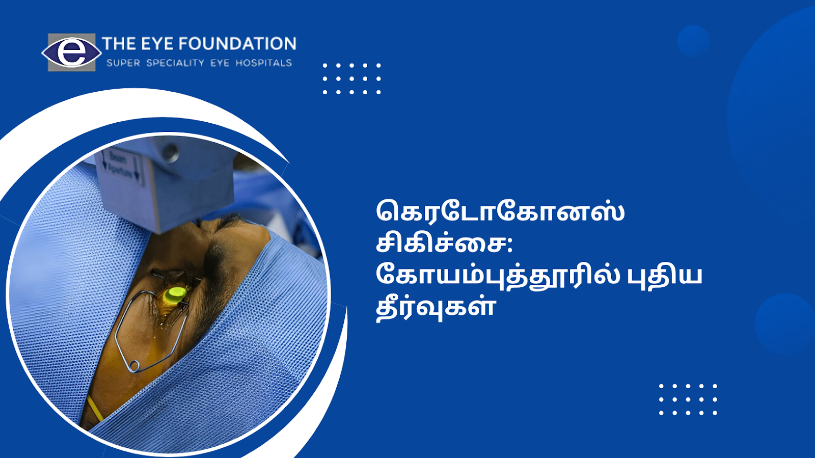 keratoconus-treatment-new-solutions-coimbatore