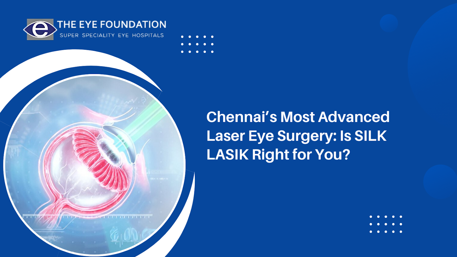 chennai-silk-lasik-laser-eye-surgery