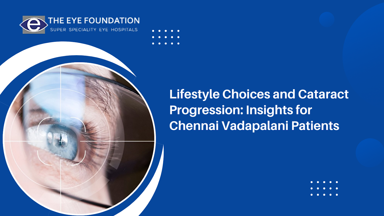 how-lifestyle-choices-affect-cataract-progression-chennai-vadapalani