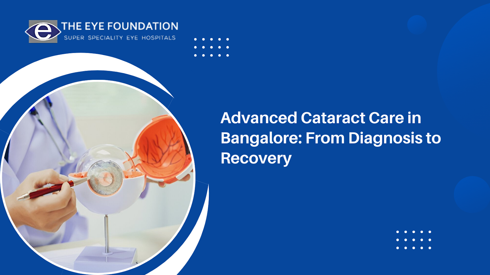Advanced Cataract Care in Bangalore: From Diagnosis to Recovery