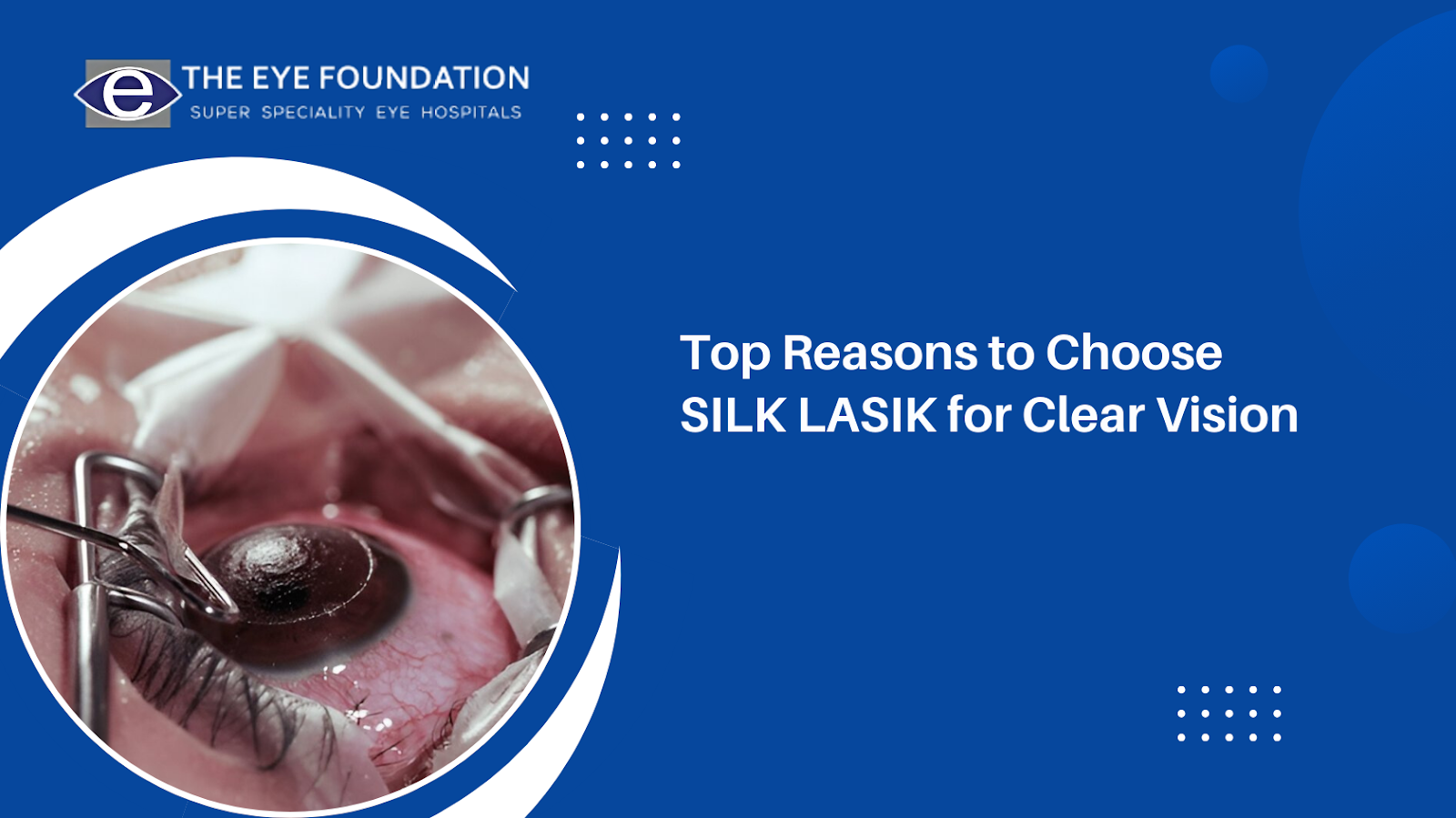Top Reasons to Choose SILK LASIK for Clear Vision