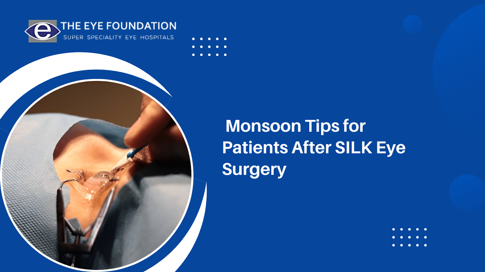  Monsoon Tips for Patients After SILK Eye Surgery