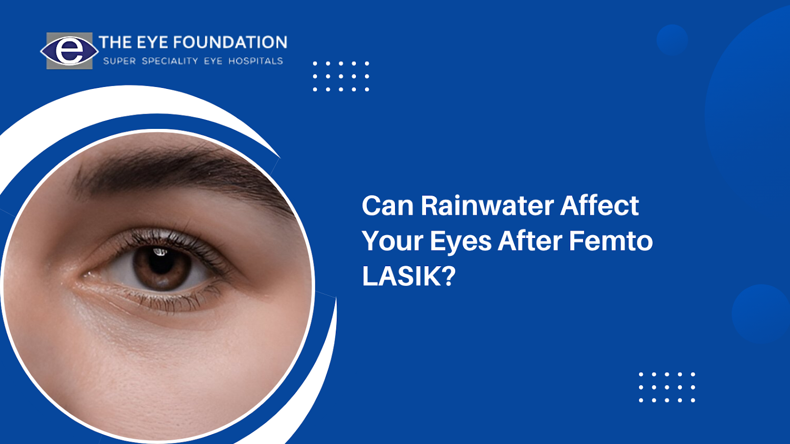 Can Rainwater Affect Your Eyes After Femto LASIK?