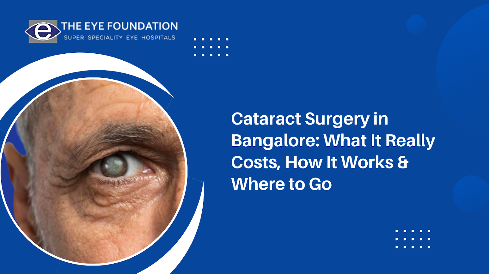 Cataract Surgery in Bangalore: What It Really Costs, How It Works & Where to Go