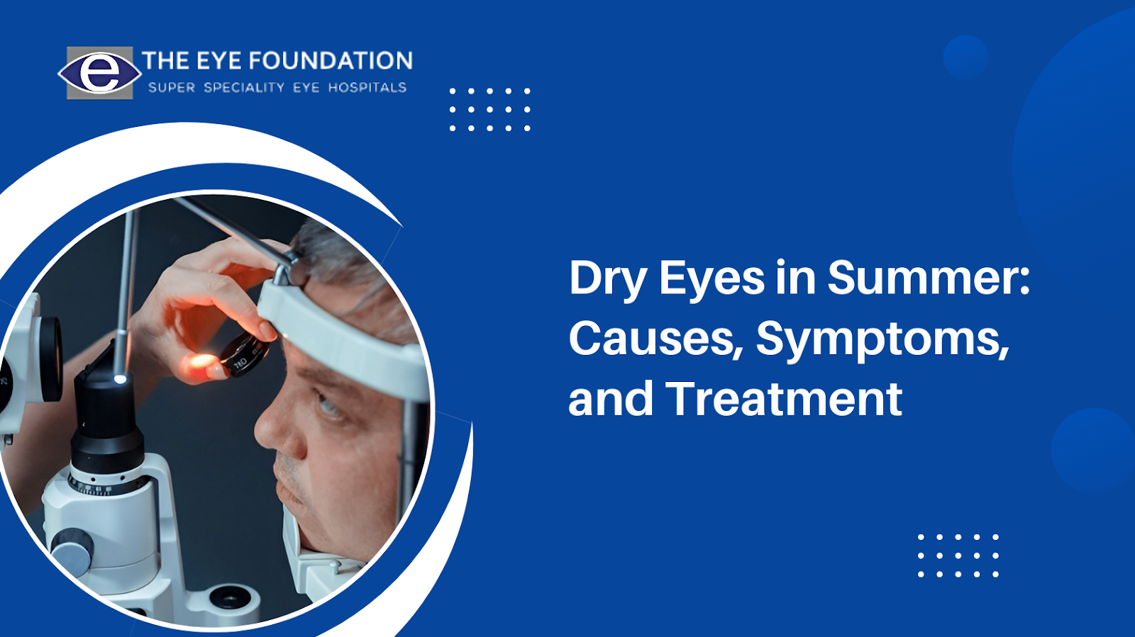 Dry Eyes in Summer: Causes, Symptoms, and Treatment