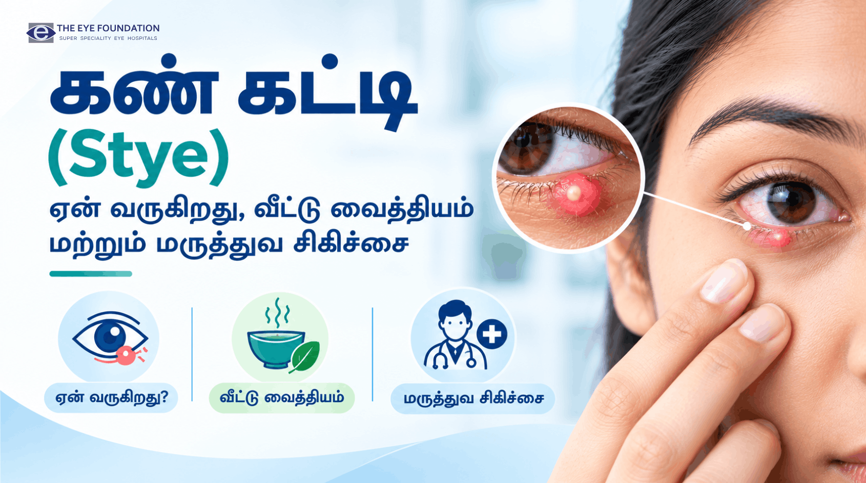 Eye Stye Home Remedies and Medical Treatment