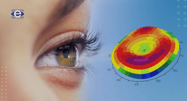 how-is-contoura-lasik-performed