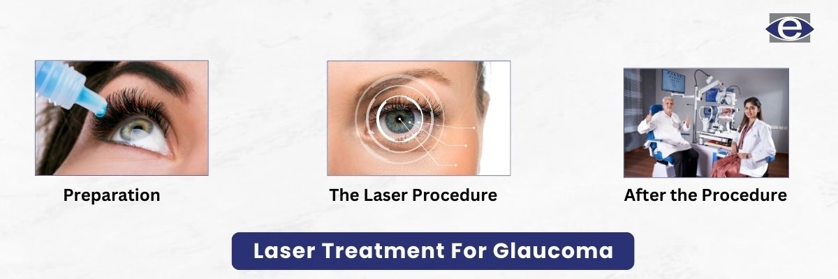 Laser Treatment For Glaucoma