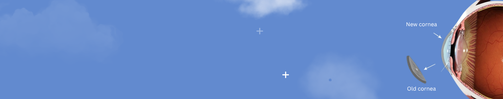 Cornea Eye Treatment in Bangalore Bellandur Banner