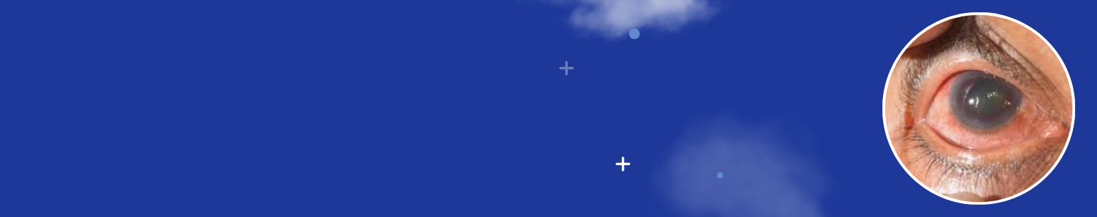 Glaucoma Care in Bangalore Bellandur Banner