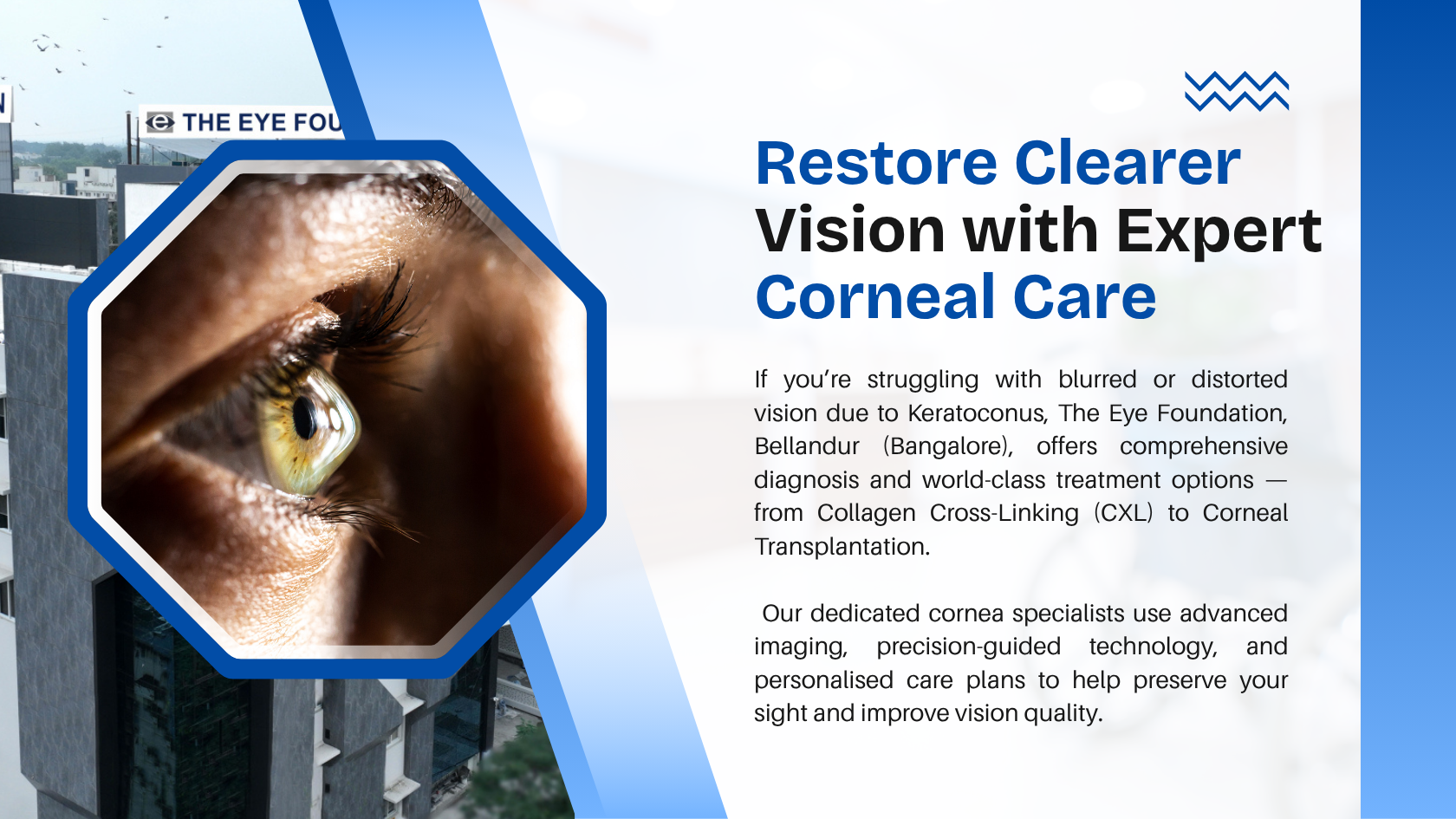 Keratoconus Treatment Options